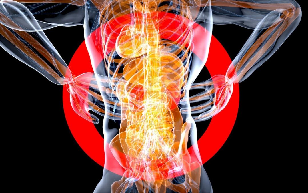 A fibromyalgia szindróma